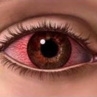 چشم قرمزی profile picture